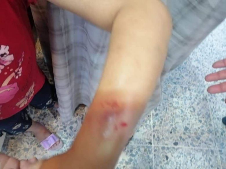كربلاء: طفلة تتعرض لتعنيف من قبل والدتها والشرطة المجتمعية تتابع الموضوع